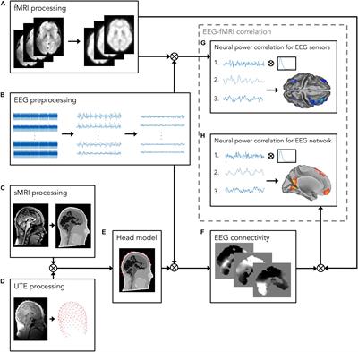 Hemodynamic Correlates of Electrophysiological Activity in the Default Mode Network